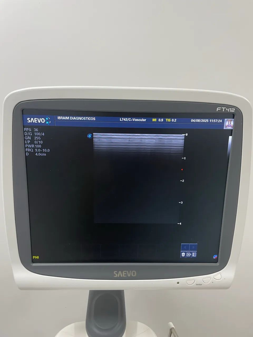 Ultrassonografia Saevo FT412 - Foto 5