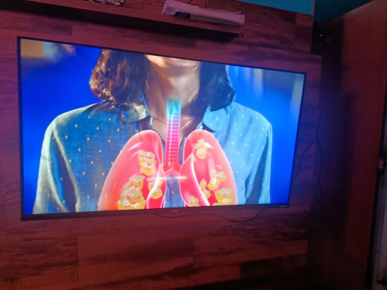 Tv 43 - Foto 2