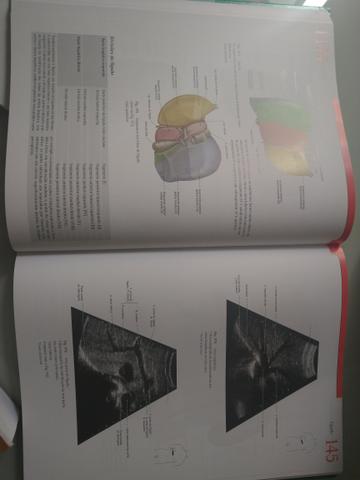 Sobotta - Atlas da Anatomia Humana - Vol. 1 e 2 - em estado novo - Foto 3