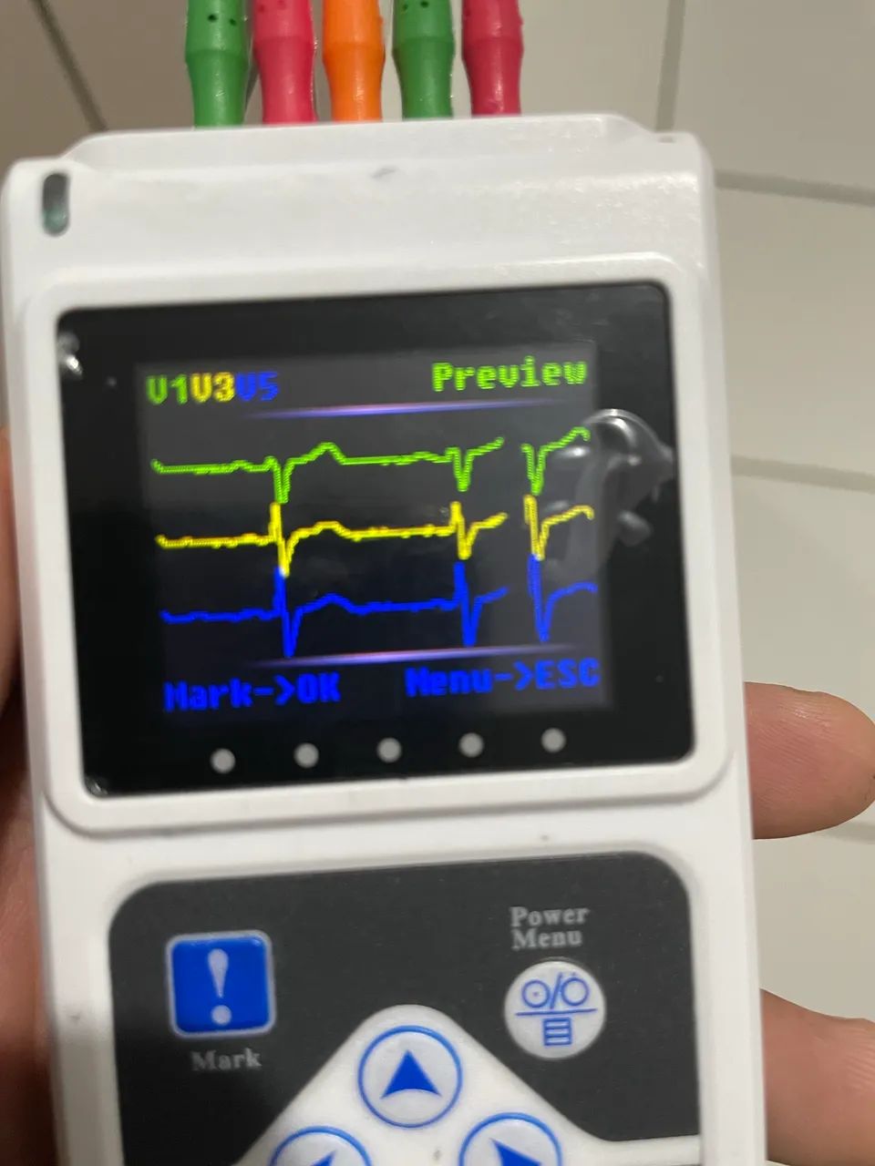 Holter 3 canais  tlc 9805 - Foto 2