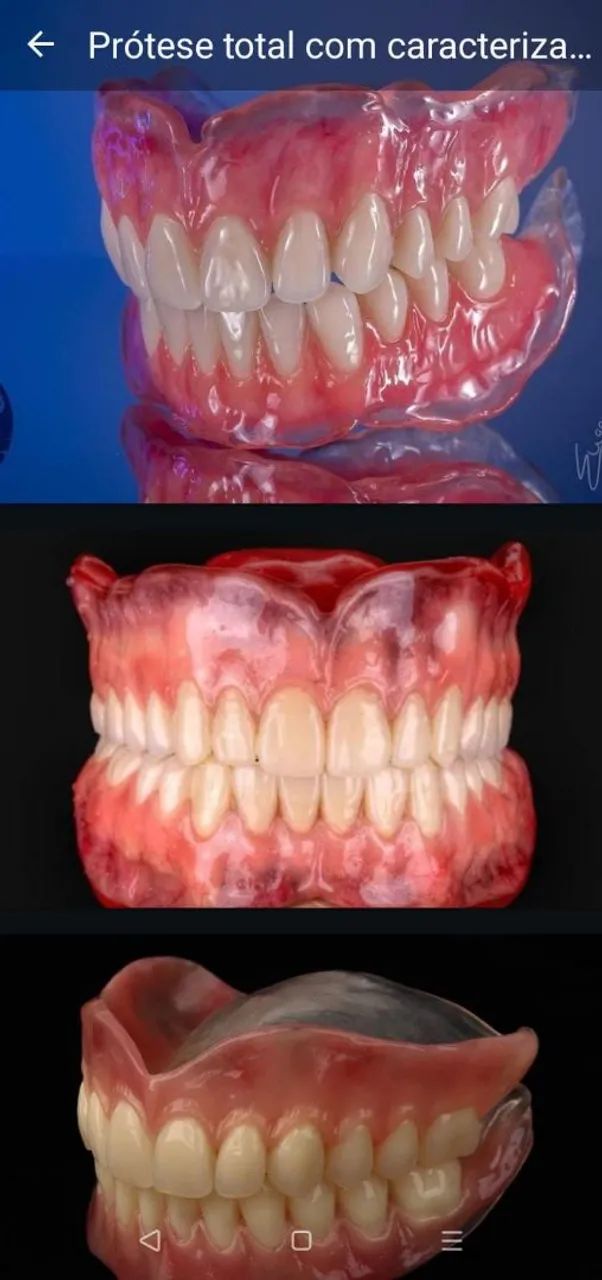 Dente Prótese Dentária  - Foto 2