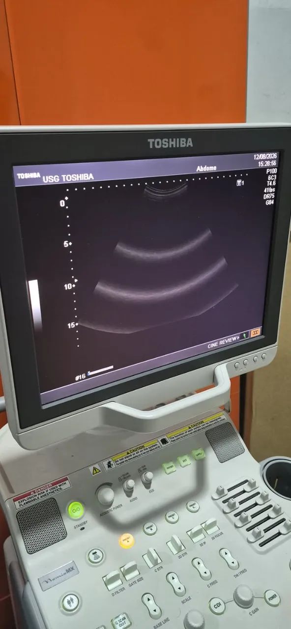 aparelho de ultrassonografia  - Foto 3