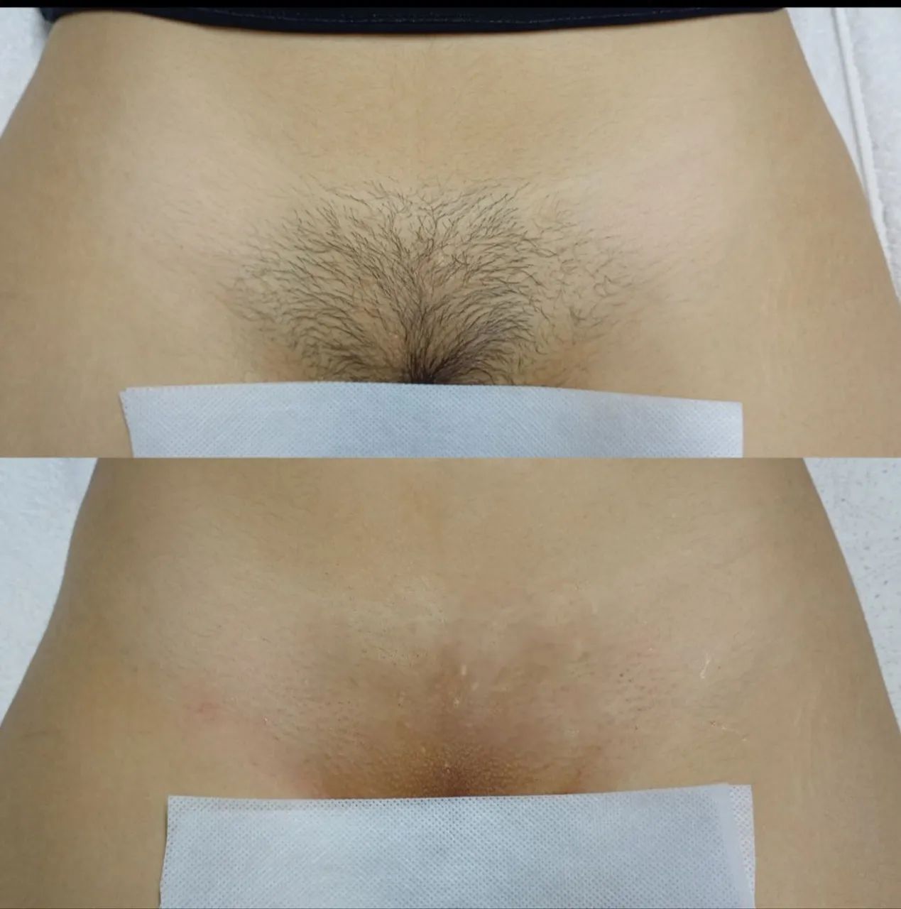 DEPILAÇÃO COM CERA EM DOMICÍLIO  - Foto 3