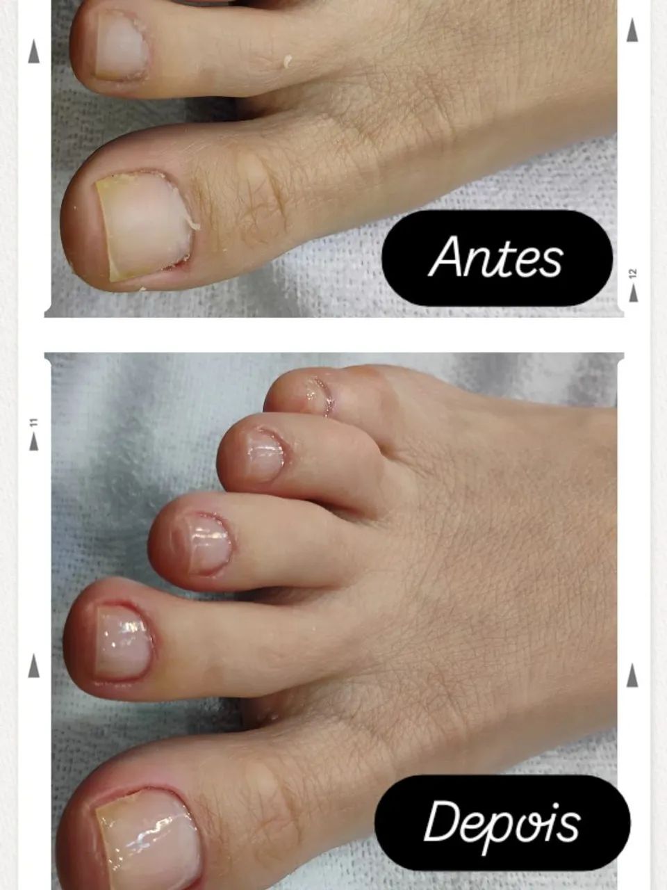 Manicure a domicílio  - Foto 3