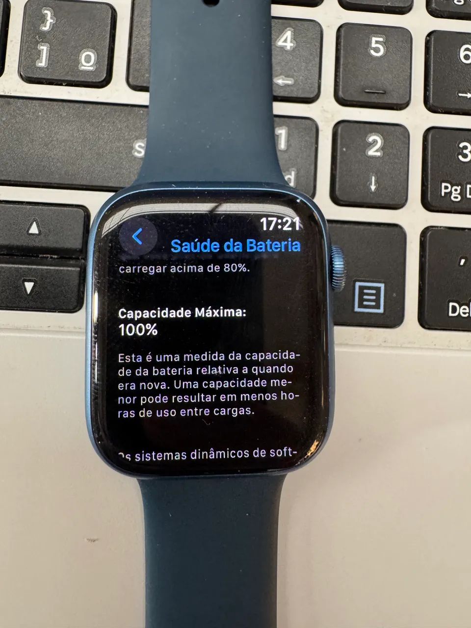 Iwatch Apple Watch Azul Serie Apple Watch Series Shopee Apple