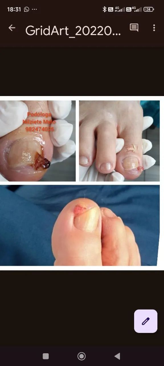 Podologia Profissional  - Foto 4