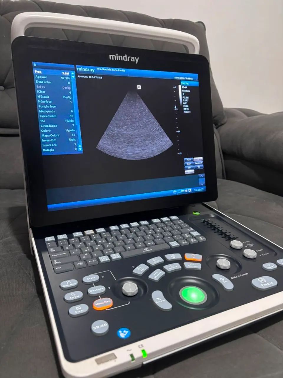 Ultrassom Mindray Z60 2022