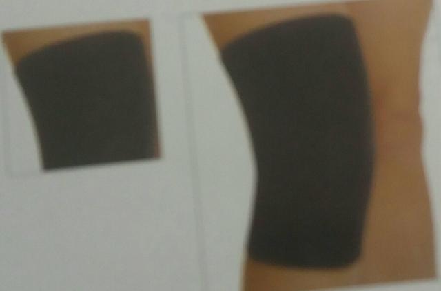 Joelheiras e imobilizador de joelhos - Foto 3