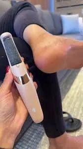 ESFOLIADOR DE CALOS - PAGUE SÓ NA ENTTREGA - Foto 5