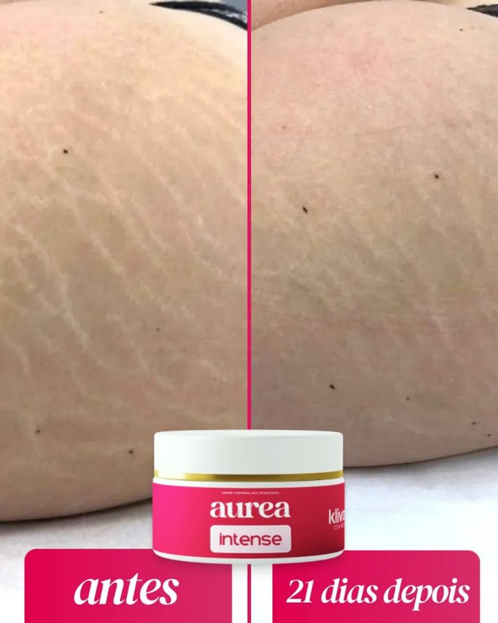 creme rosa para estrias e celulites - Foto 5