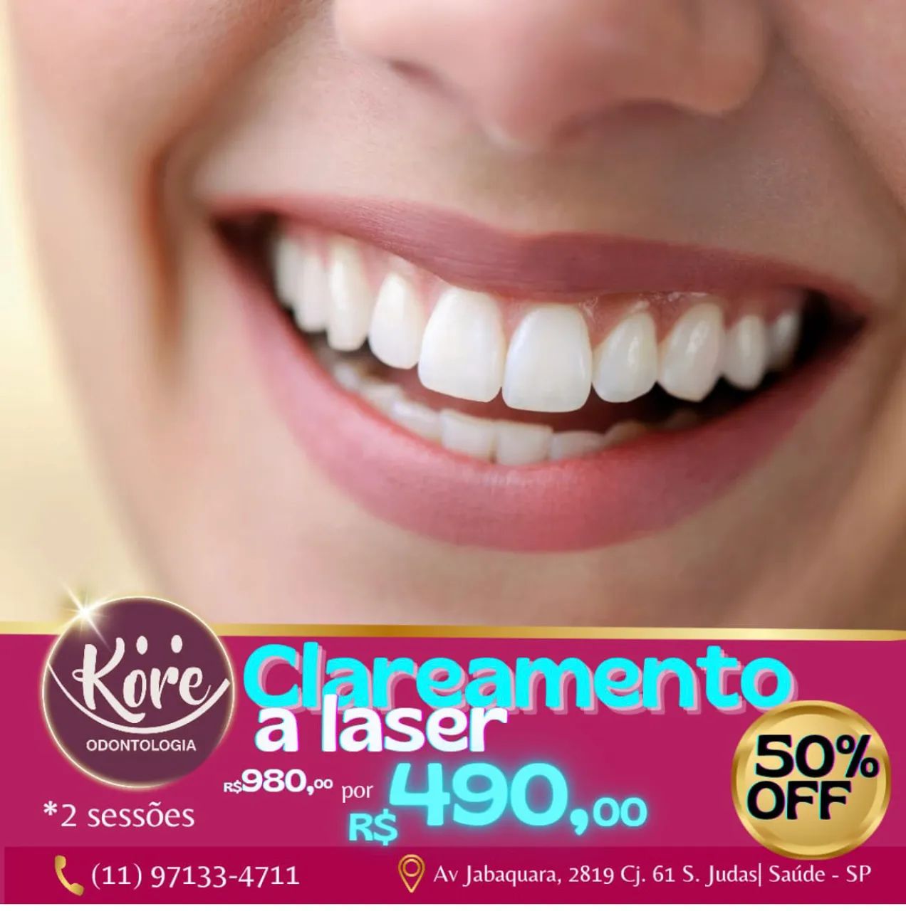 Dentista Clareamento no Consultório  - Foto 2