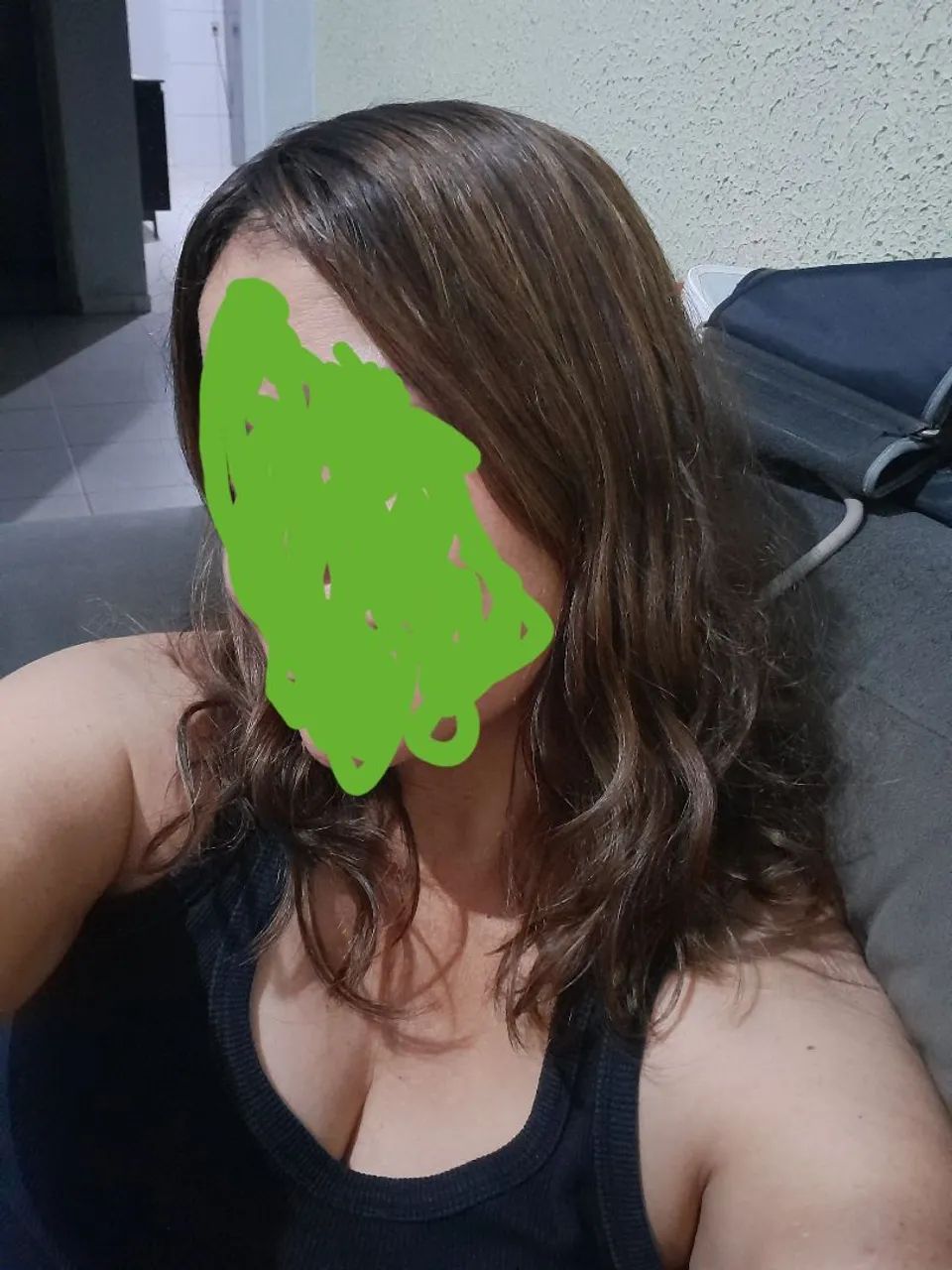 Topo capilar humano