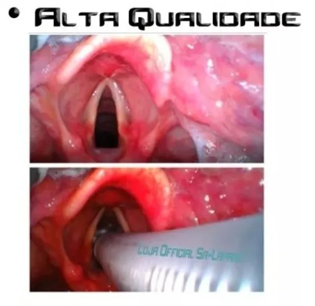 Maleta para VideoLaringoscopio Completo Com todas Laminas - Foto 2