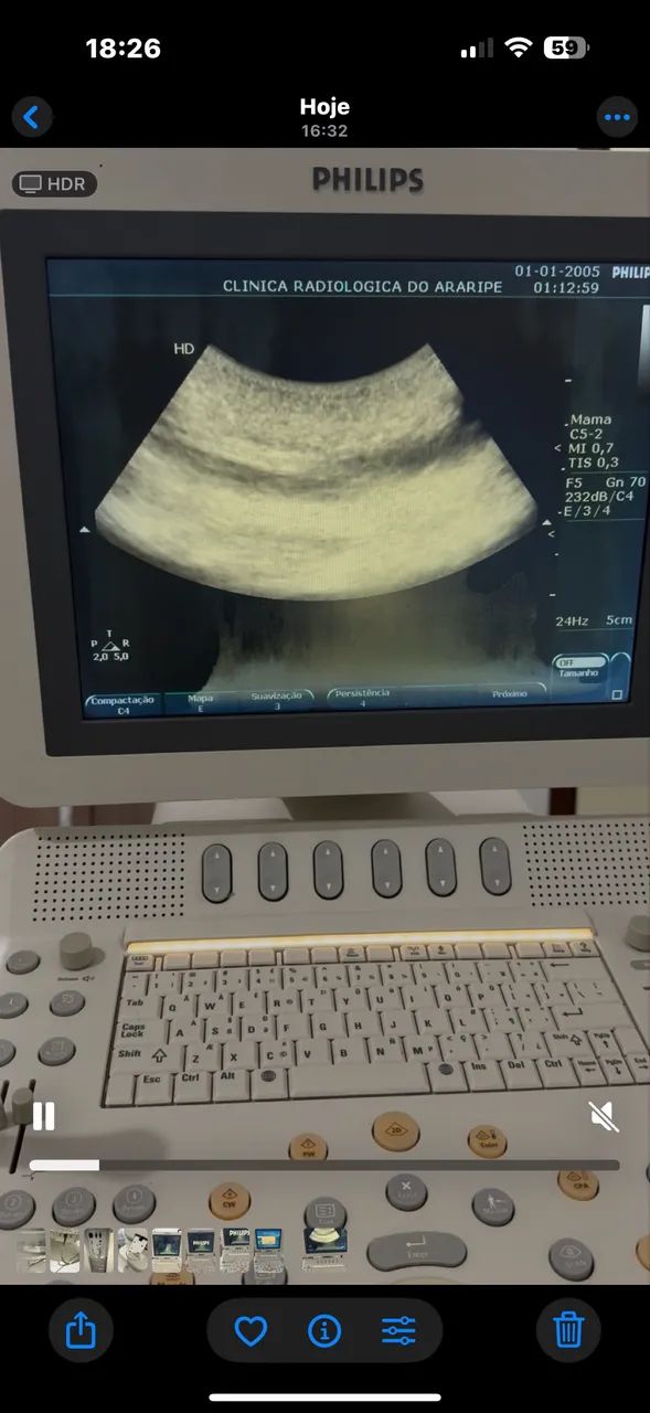 Aparelho USG- HD7 - Foto 5