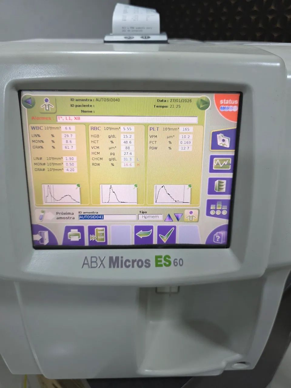 Analisador hematologico micros 60 ES - Foto 2