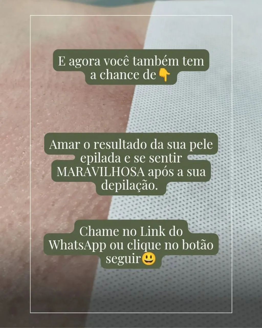 Depilação corporal c cera - Foto 3