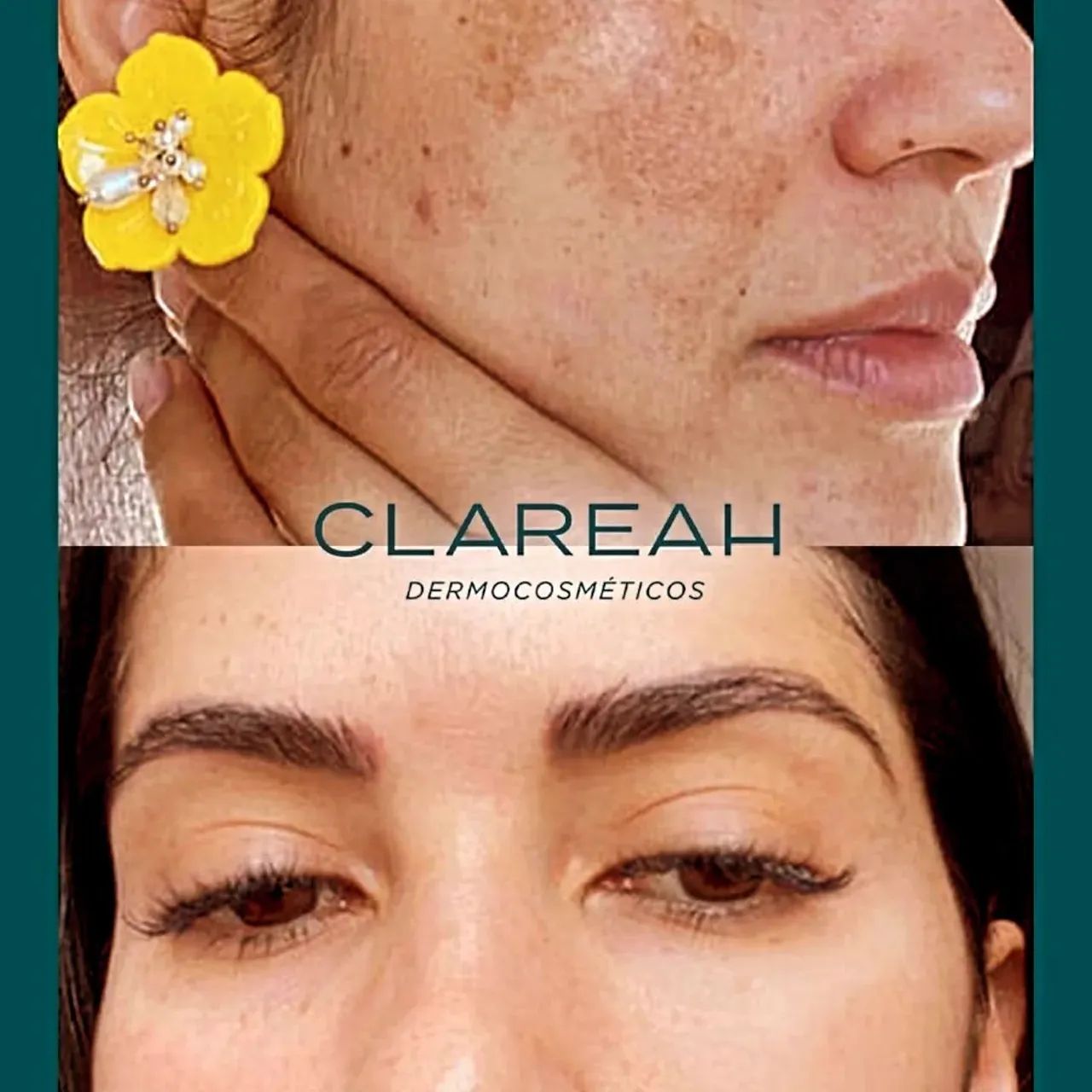 Sérum Clareah - clareia manchas e melasmas  - Foto 3