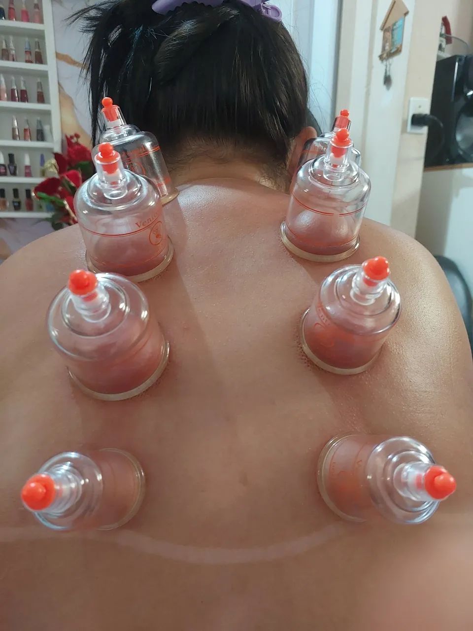 Fisioterapia  - Foto 3