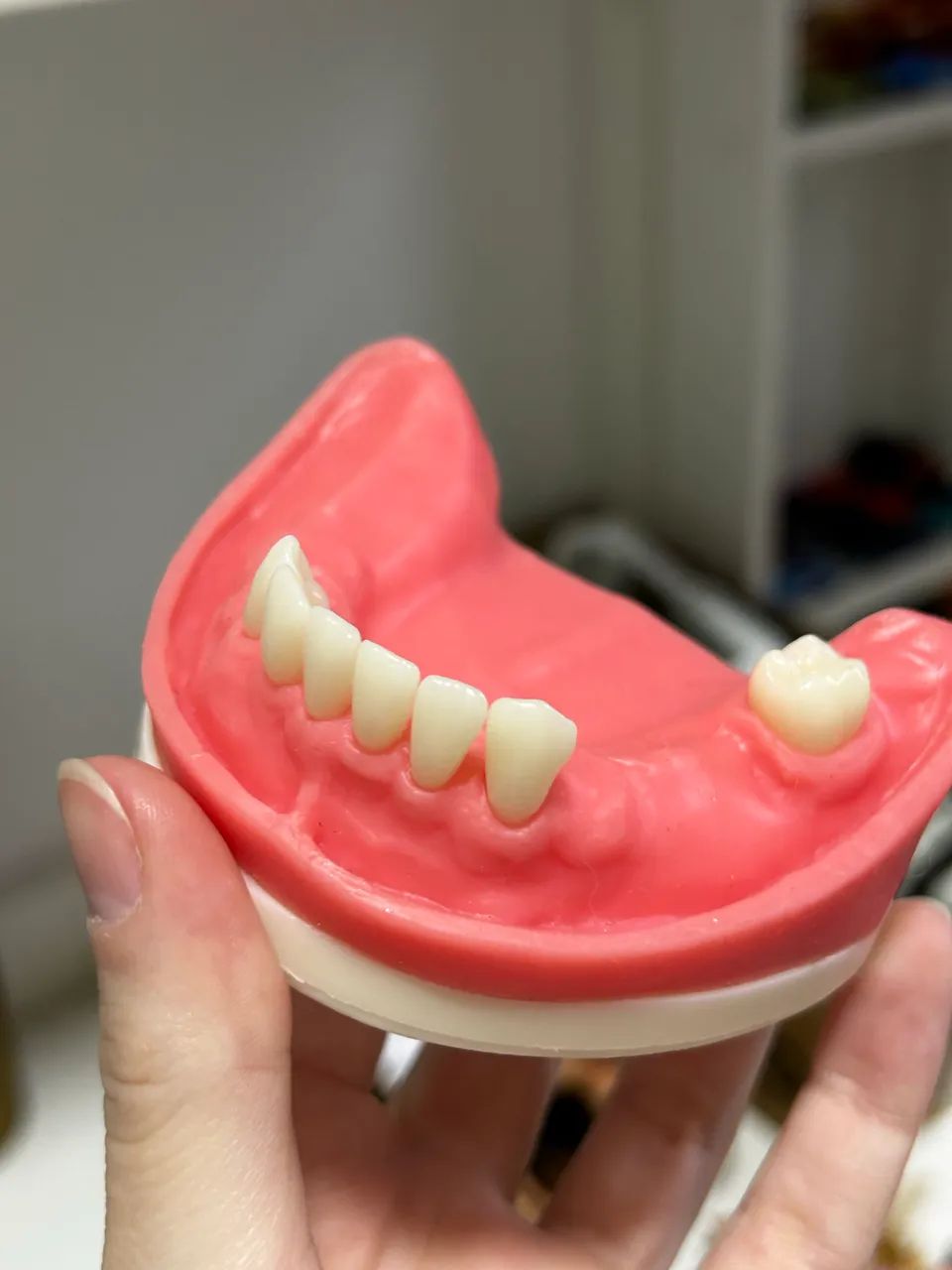 Manequim Pronew Prótese Total e Prótese Parcial Removível - Refil  - Foto 2