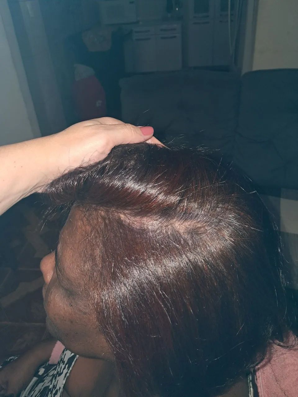 Escova Redutora  - Foto 4