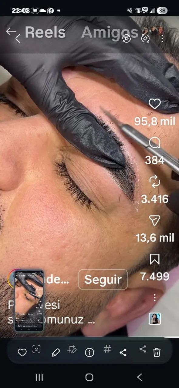 *Depilação cera ,máquina  - Foto 5