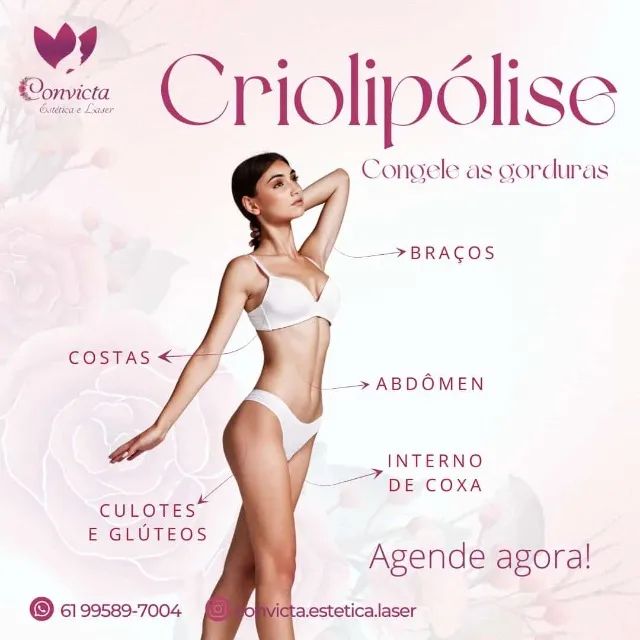 Criolipólise day 22/07/25 - Foto 2