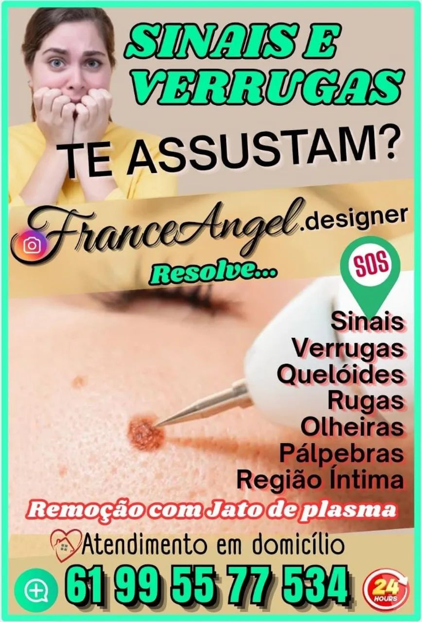 Sinais e Verrugas te incomodam? EU RESOLVO com Jato de plasma