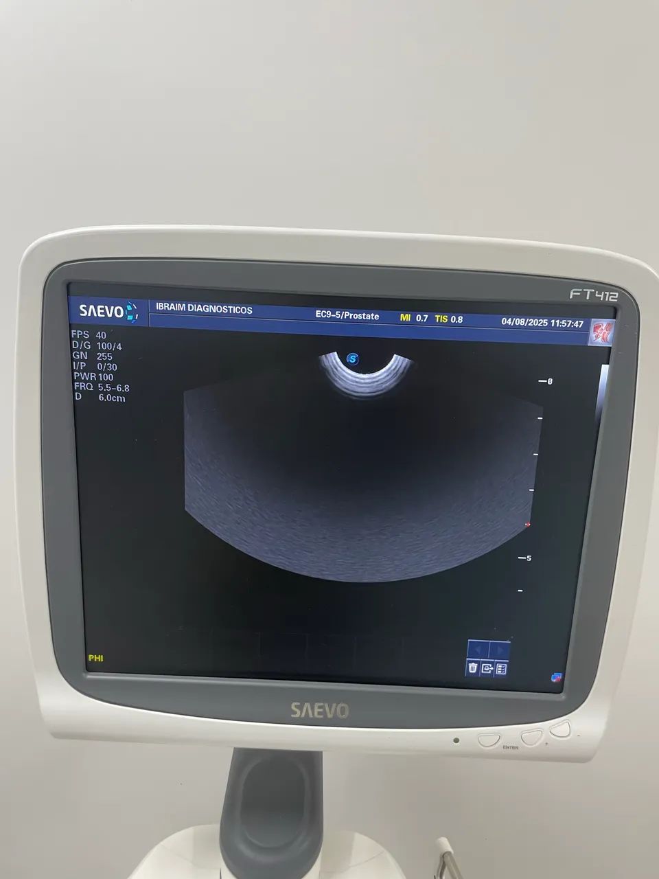 Ultrassonografia Saevo FT412 - Foto 6