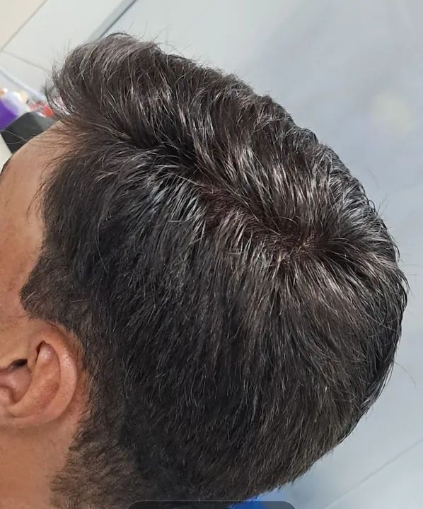 Prótese capilar Masculina . - Foto 2