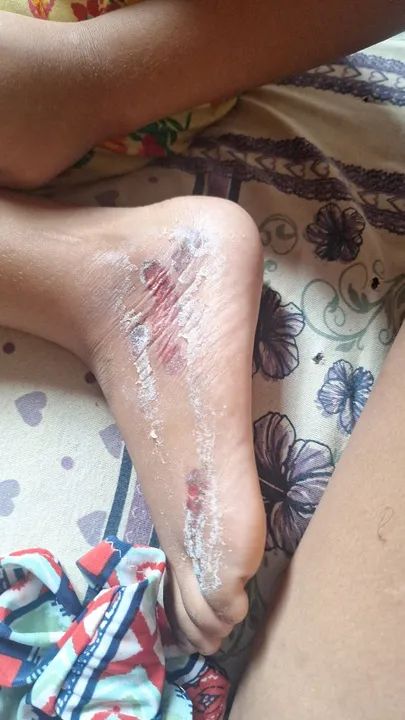 Colchão de espuma - e colchão ortopédico  - Foto 5