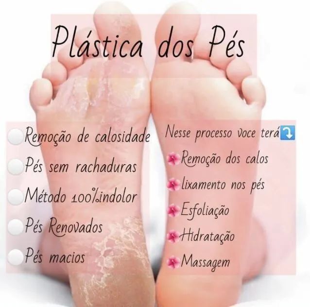 Podologia Preventiva - Cuidados com seus pés! - Foto 3