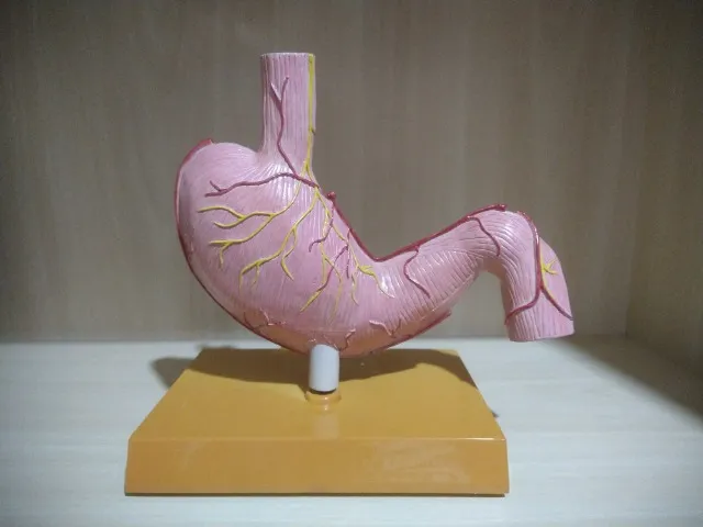 Modelo Anatômico De Estômago Humano Com Patologias (usado)