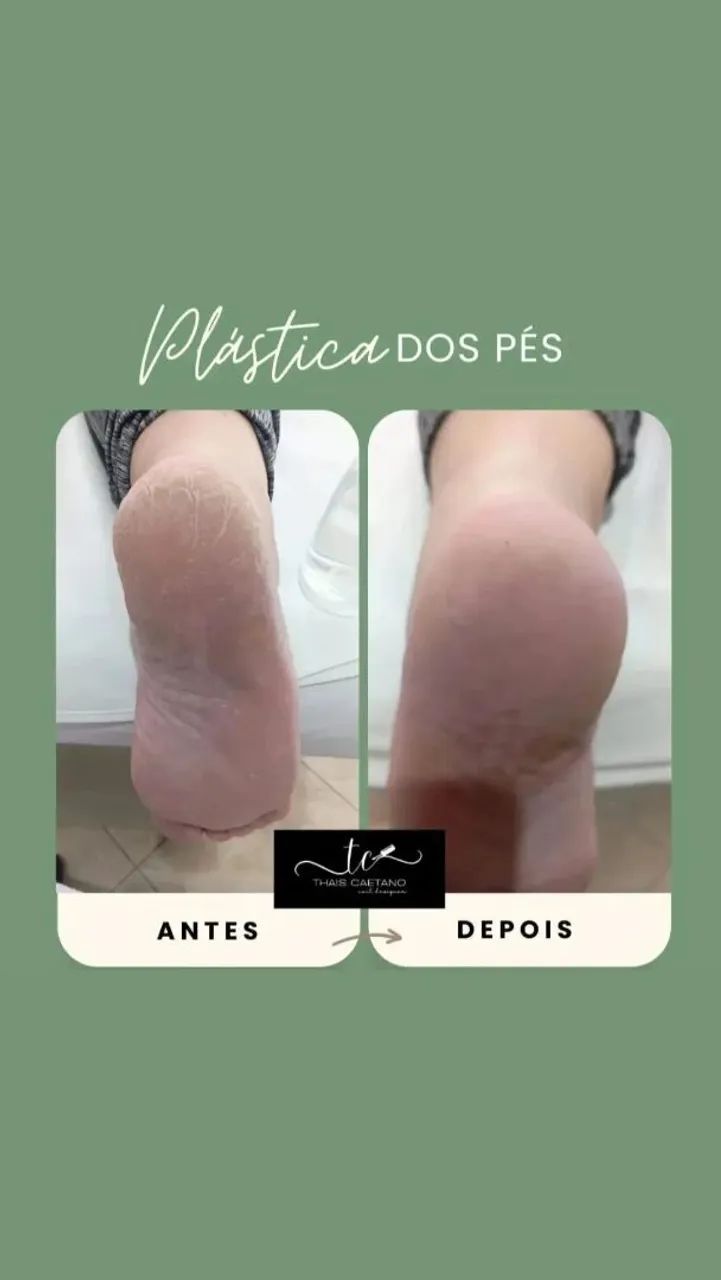 Manicure e Pedicure | Tatuquara | Atendimento a Domicílio - Foto 3