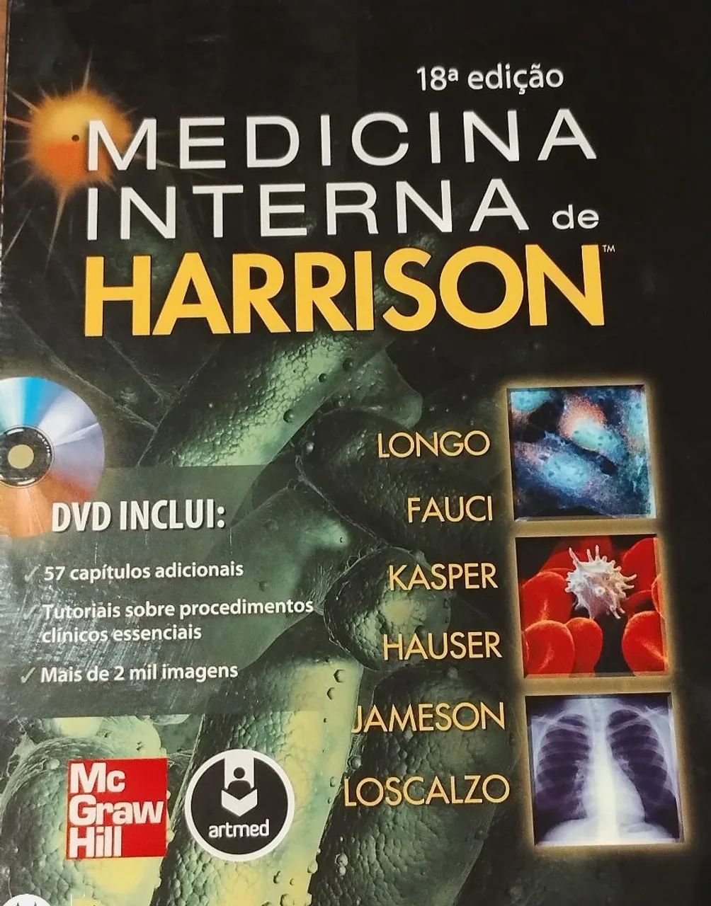 Medicina Interna de Harrison - 18ª Edição