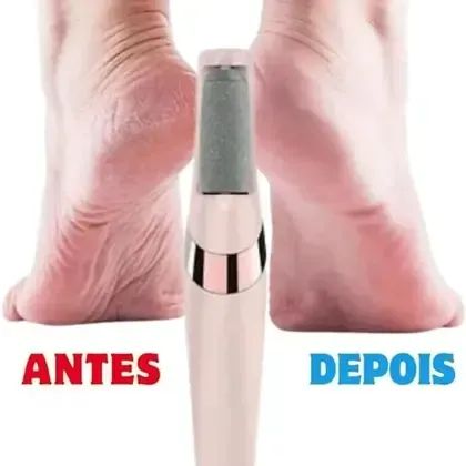 ESFOLIADOR DE CALOS - PAGAMENTO NA ENTREGA - Foto 5