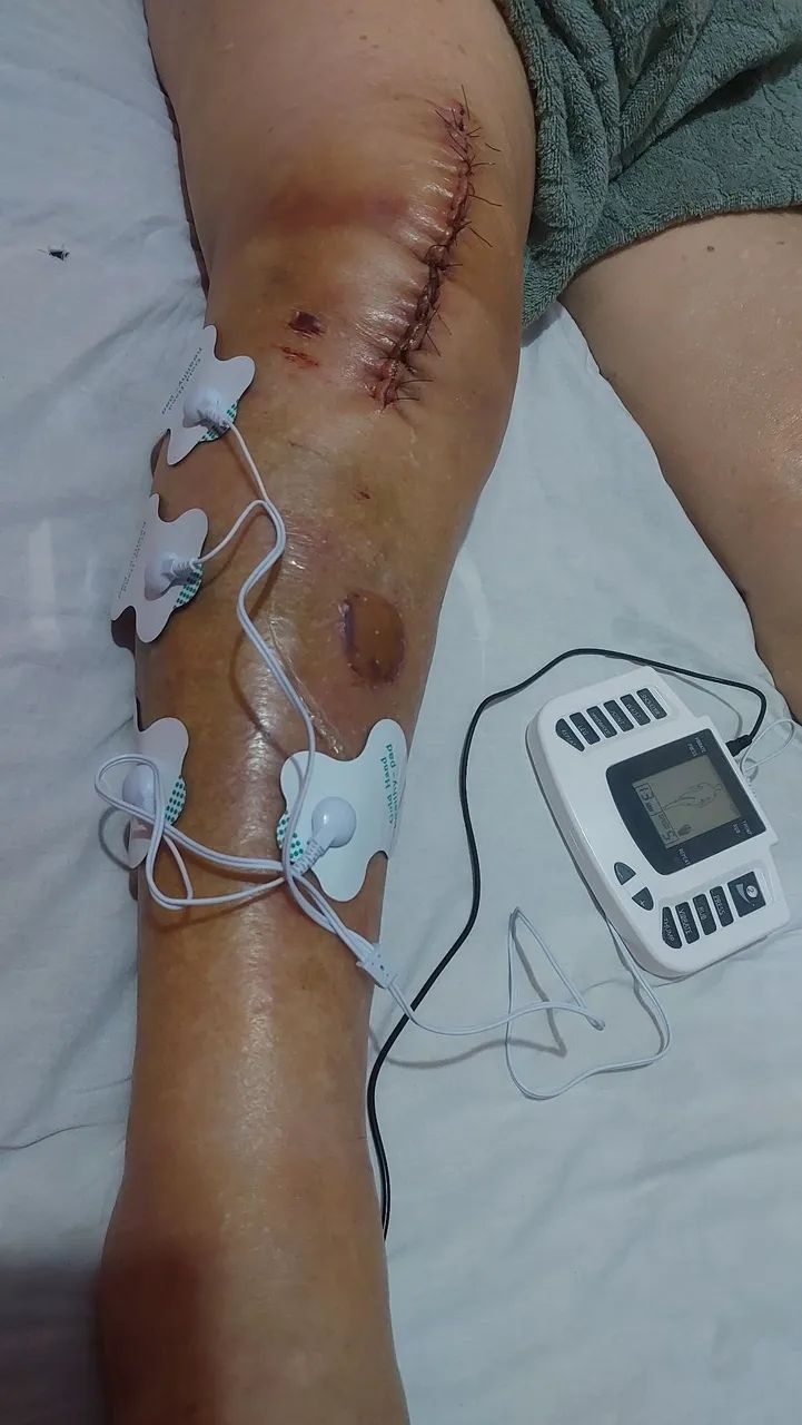 Fisioterapia  - Foto 4