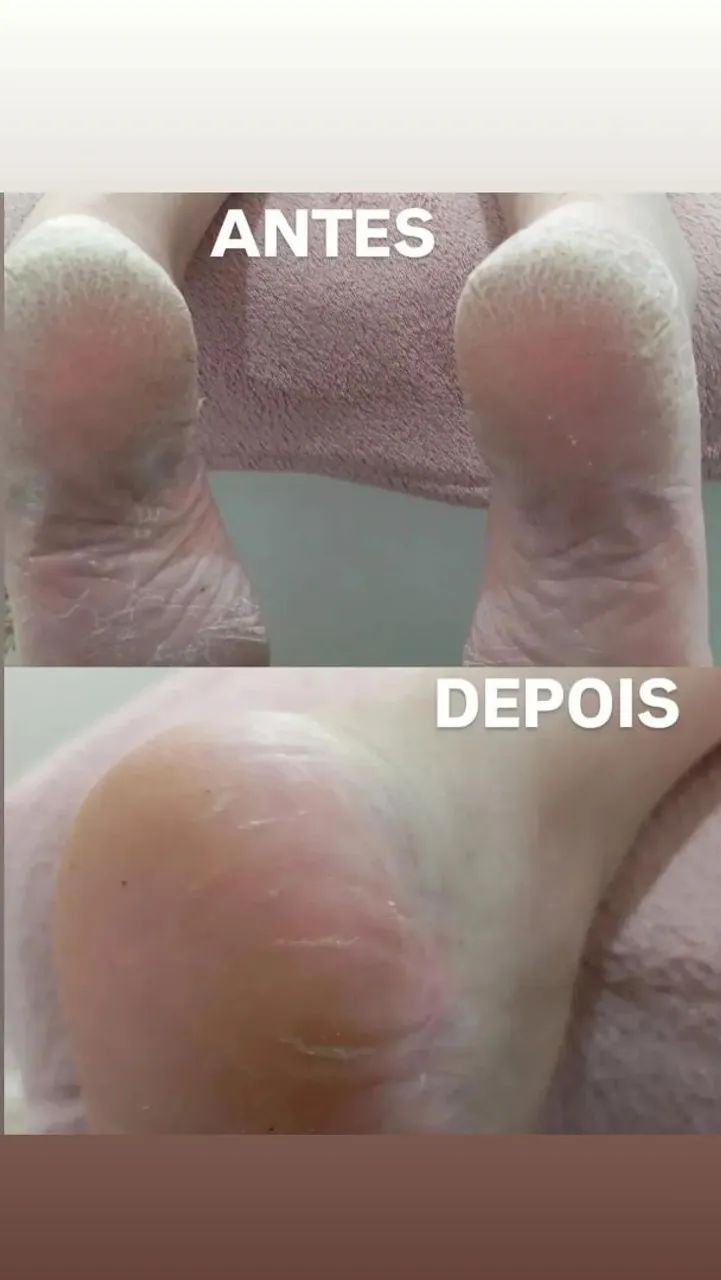 Manicure e Pedicure | Tatuquara | Atendimento a Domicílio - Foto 2