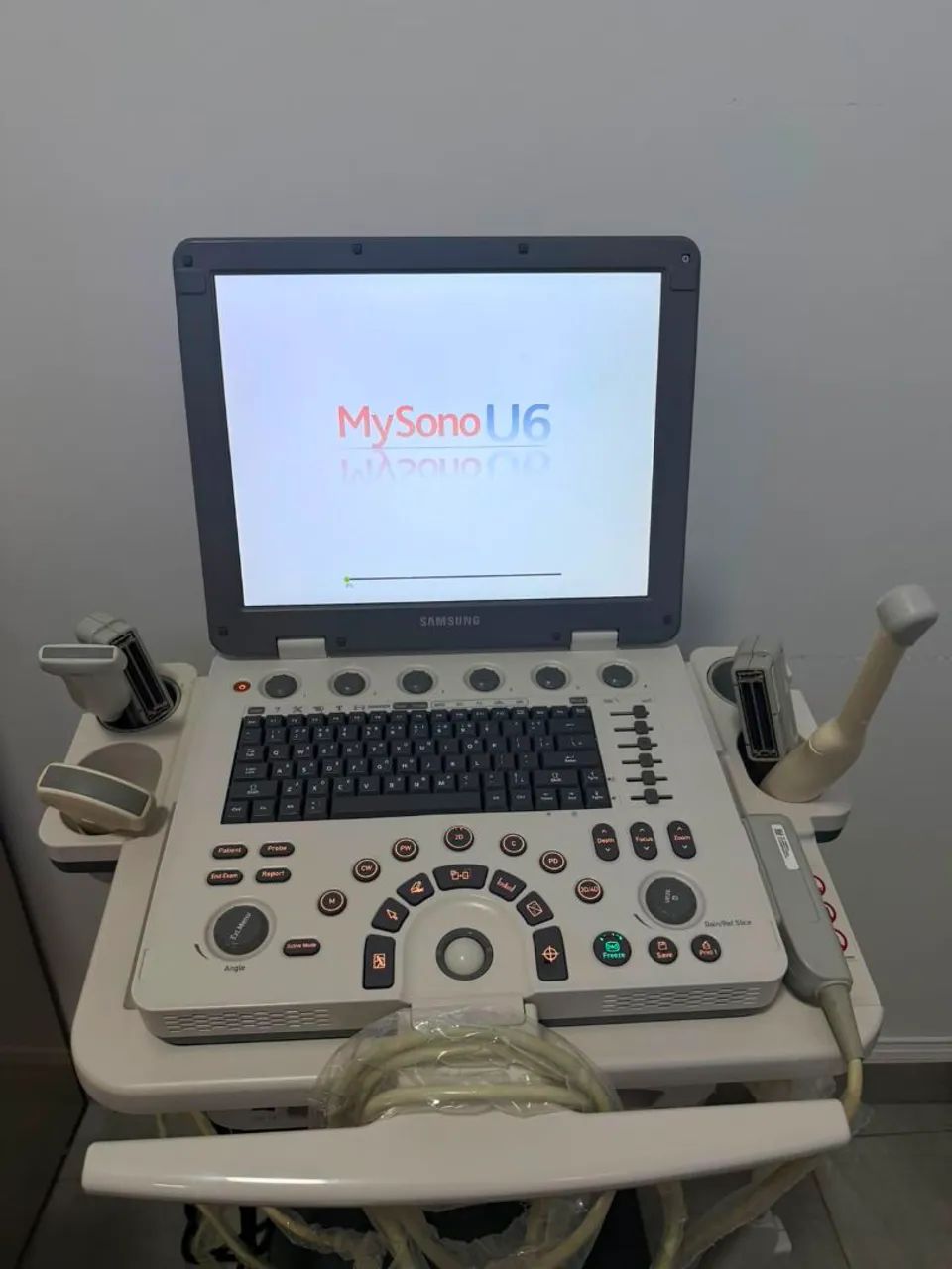 Ultrassom Samsung U6 - Foto 3