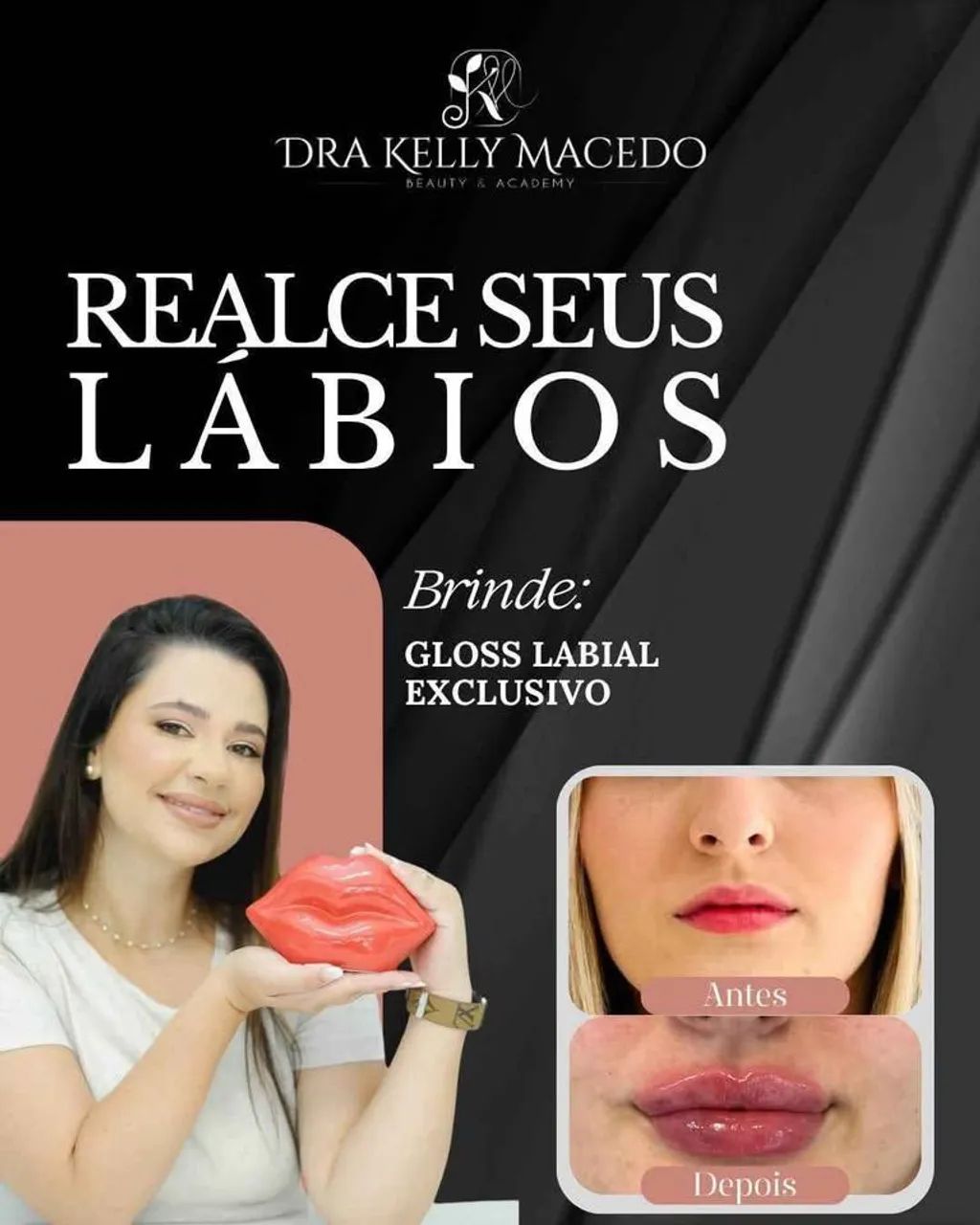 Preenchimento labial