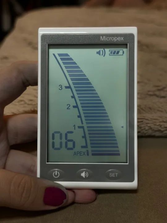 Localizador Apical - Foto 4