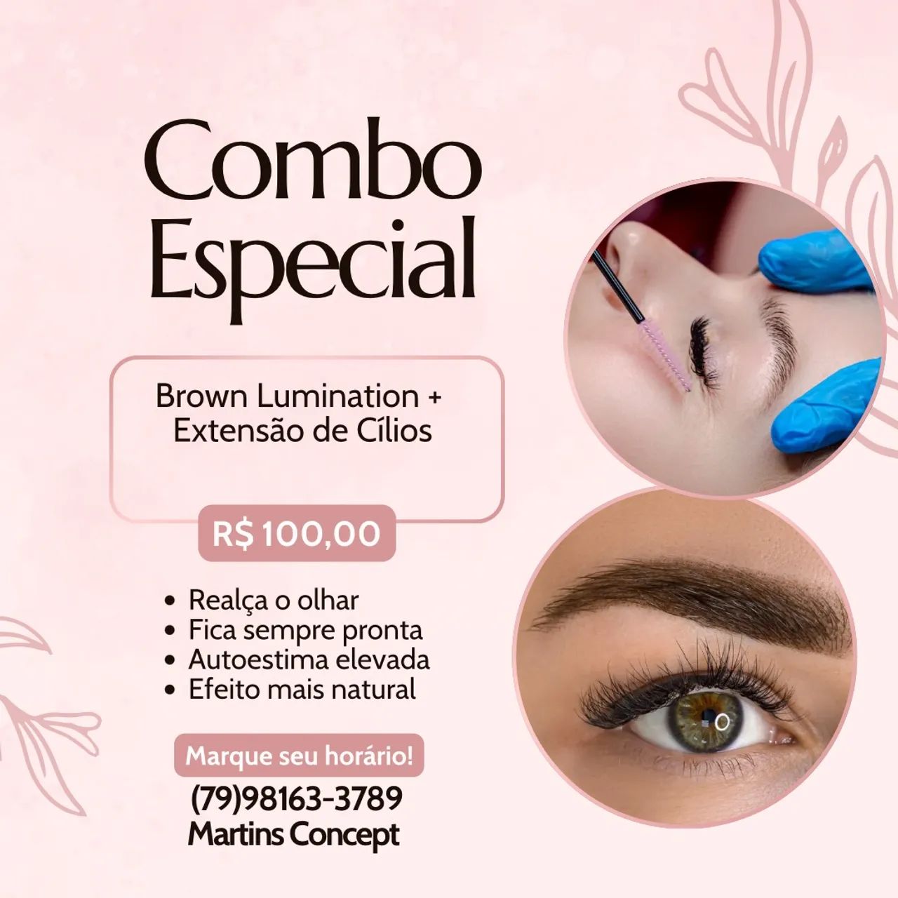 Promoção outubro Rosa - Foto 3