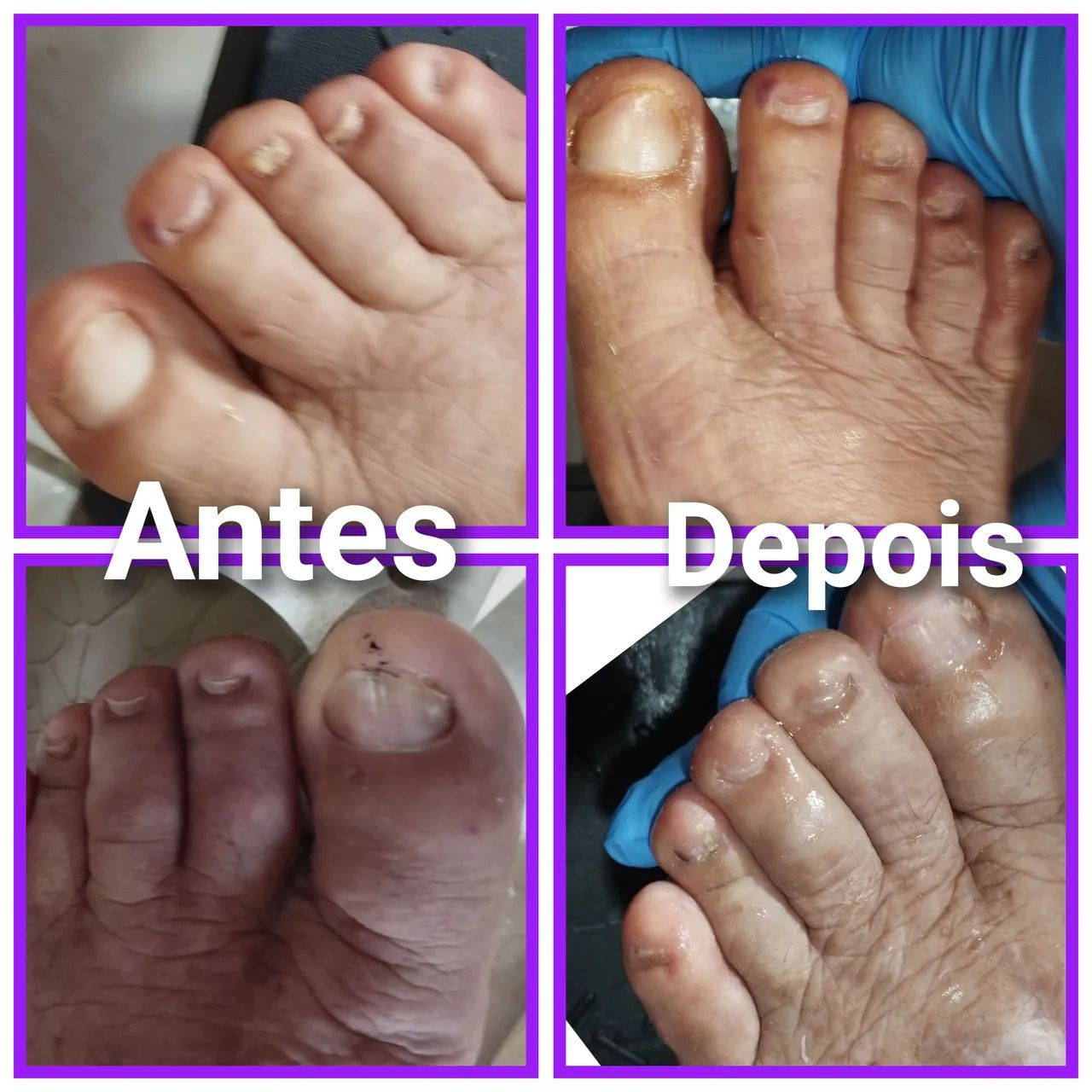 Podologia Profissional  - Foto 5