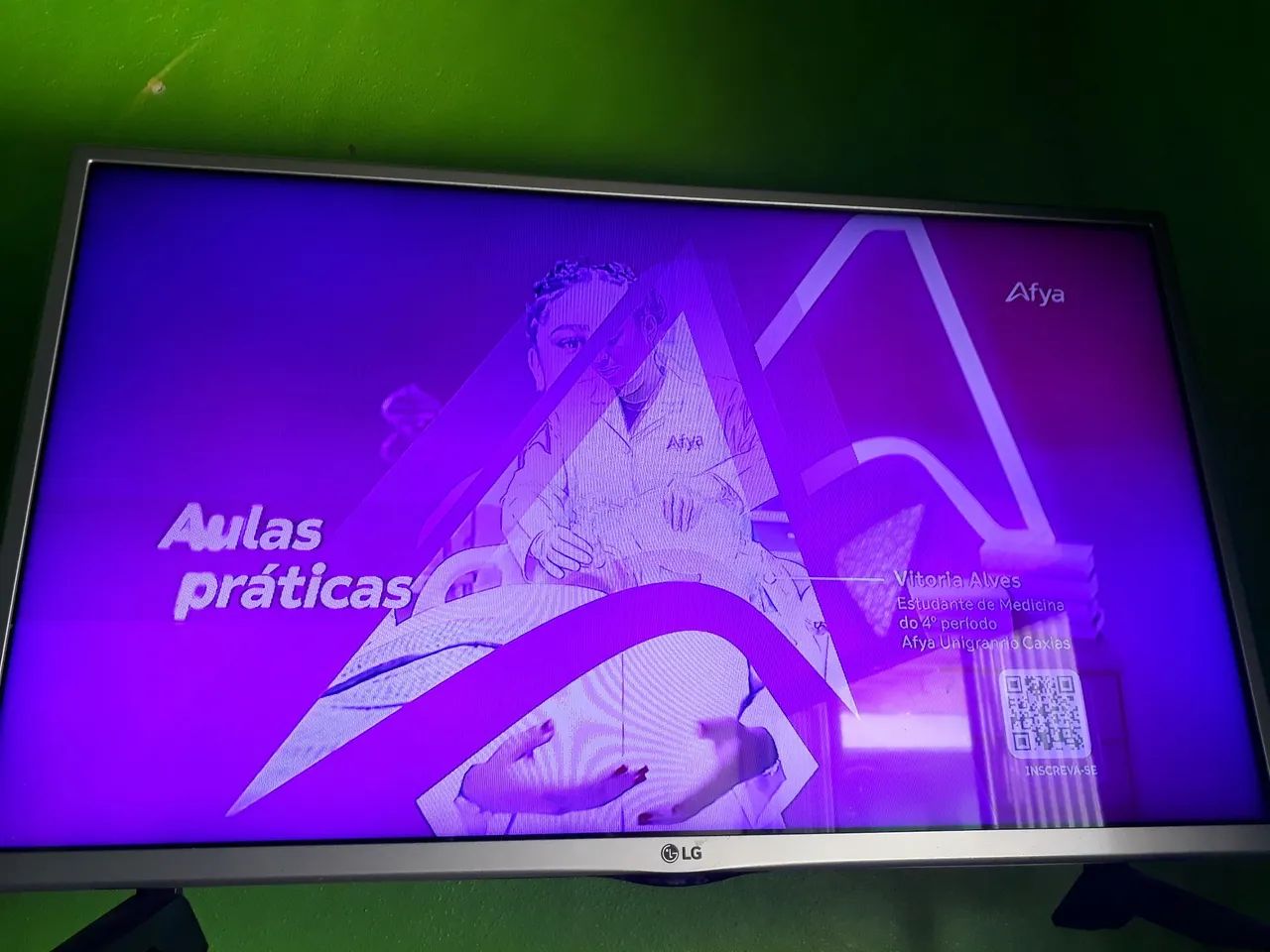 TV LG 32 polegadas  - Foto 2