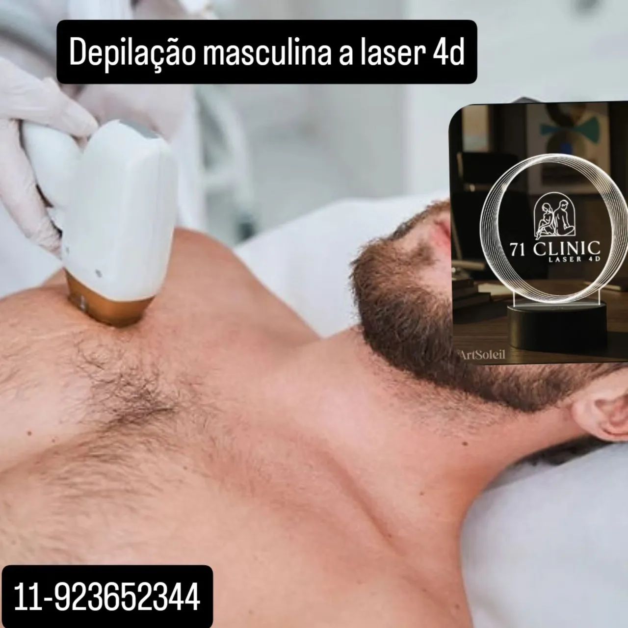 Depilação a laser 4D definitiva  - Foto 3