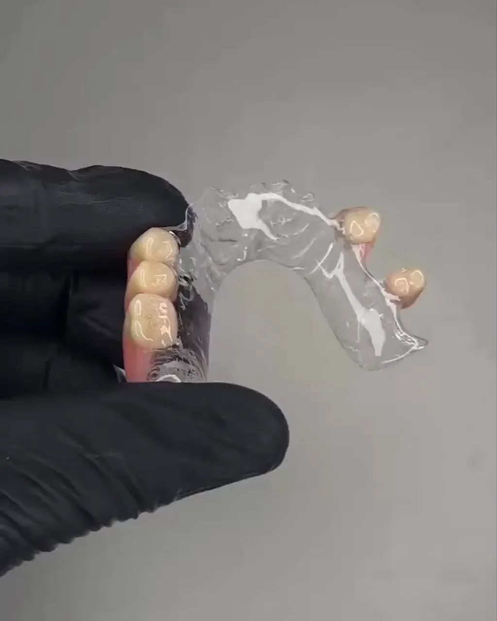 PPR acrílica prótese dentária acrílica  - Foto 2