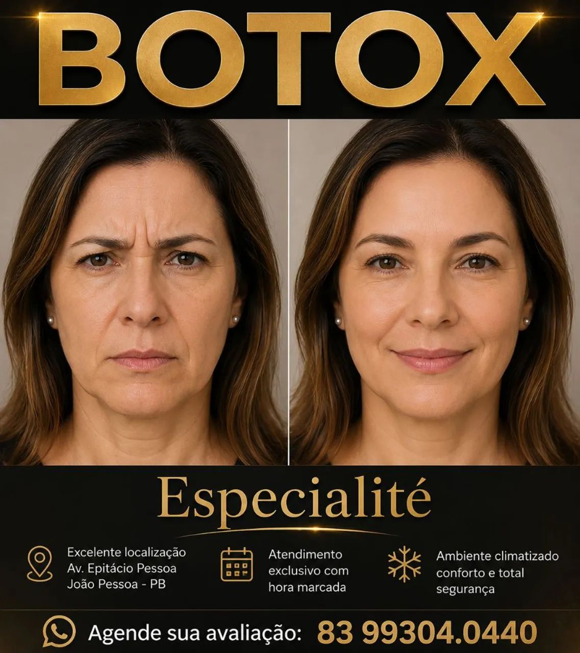 Rejuvenesça seu rosto com Botox e resultados naturais