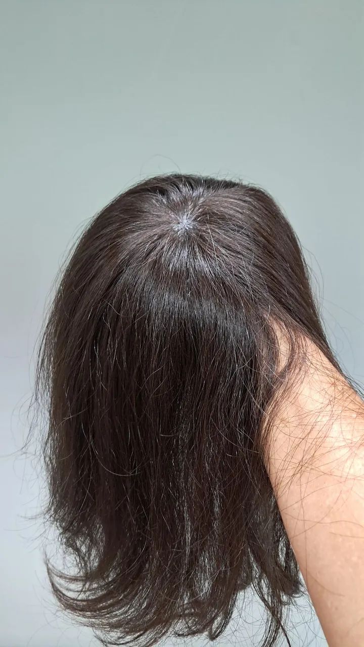 Topo de cabelo humano para disfarçar entradas - Foto 2