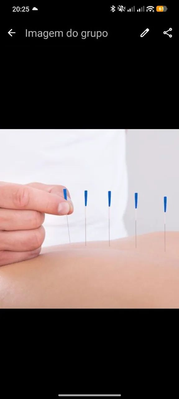 Acupuntura e outras terapias  - Foto 4