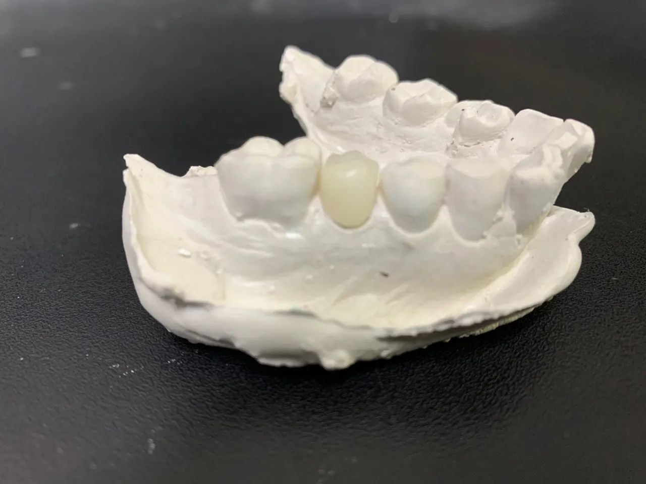 Prótese dentária a partir de 200 reais  - Foto 3