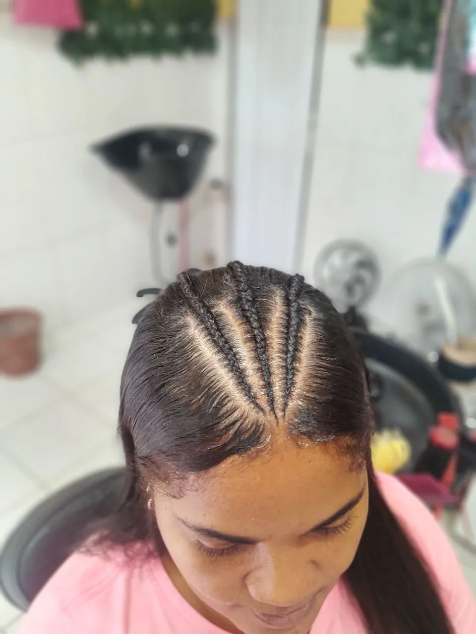 Colocação de cabelo  - Foto 4